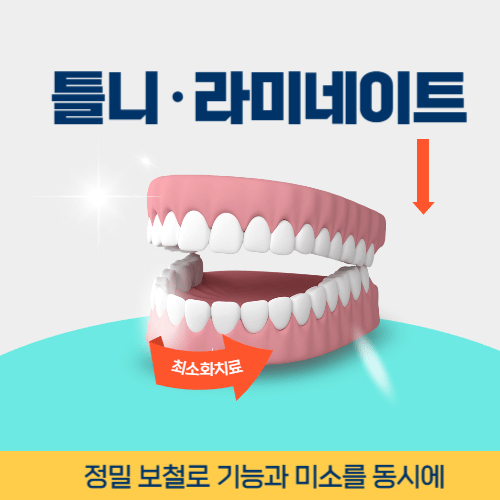 군산치과 군산시 치과 틀니 라미네이트