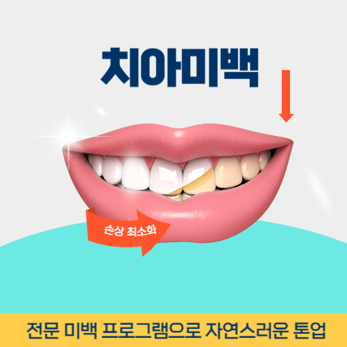 군산치과 군산시 치과 치아미백