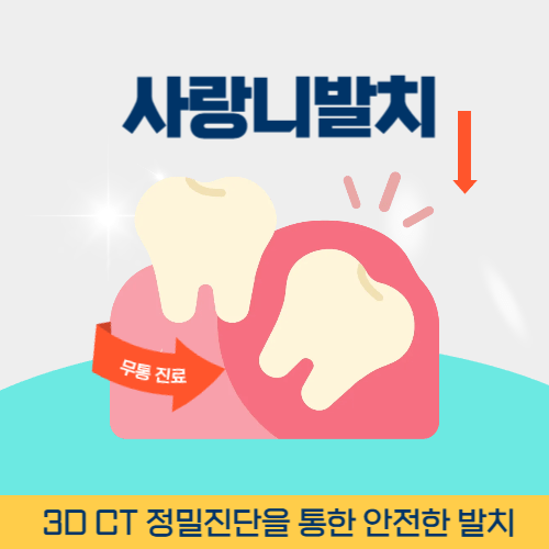군산치과 군산시 치과 사랑니 발치