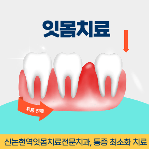 군산치과 군산시 치과 잇몸치료